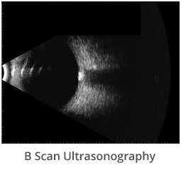 b-scan-ultrasonography