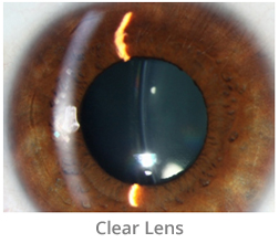 clear-lens