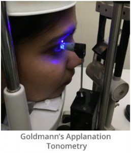 goldmanns-applanation-tonometry