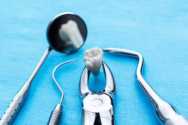 tooth-extraction-clinic-gurgaon